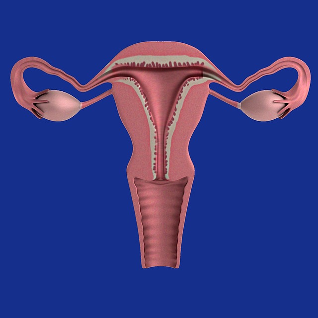 hiperestimulacion ovarica